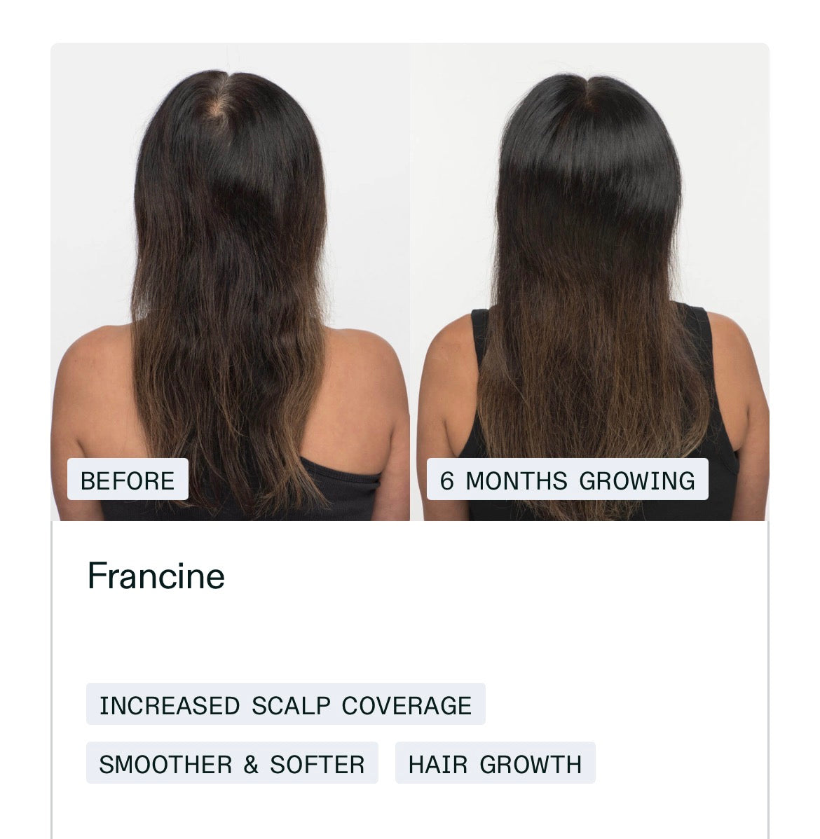 NUTRAFOL Women’s Vegan Hair Growth Pack