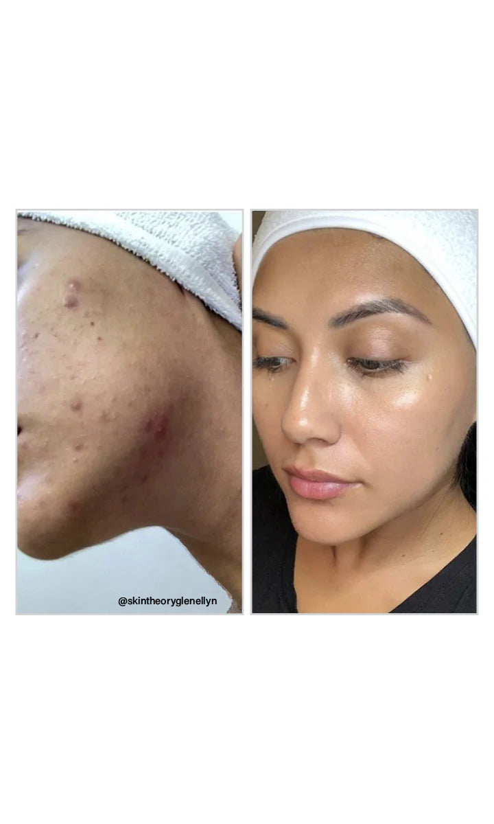 Vivant 8% Mandelic Acid 3 in 1 Serum