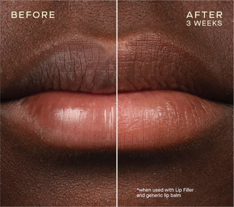 Ourself Lip Filler