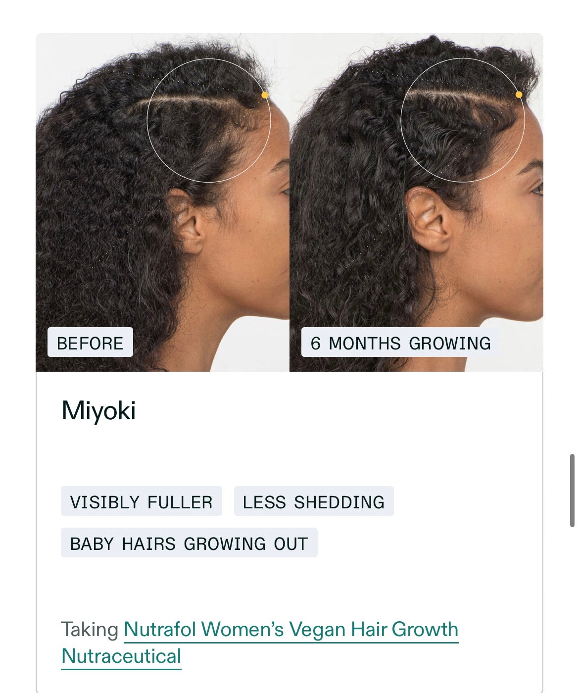 NUTRAFOL Women’s Vegan Hair Growth Pack