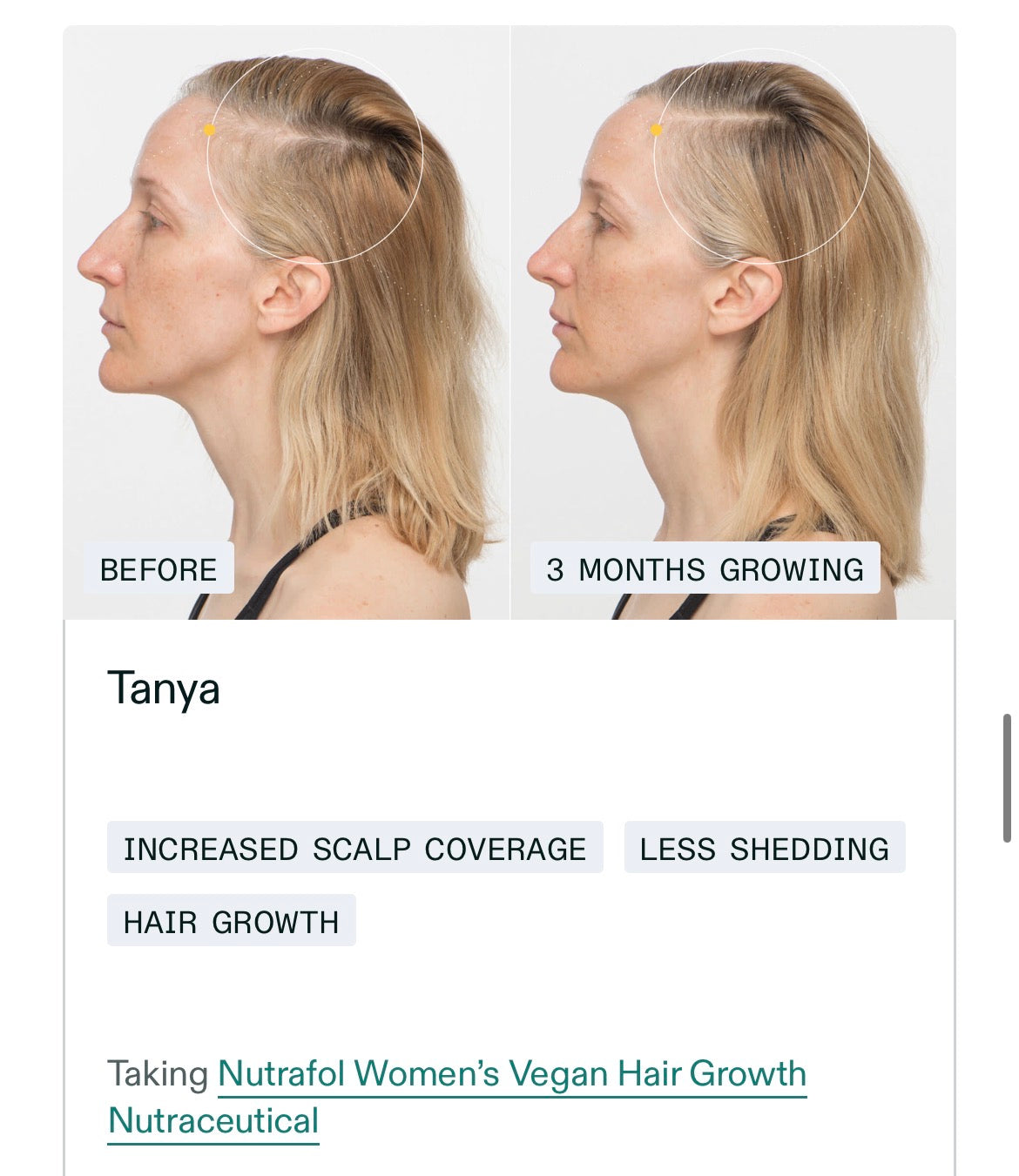 NUTRAFOL Women’s Vegan Hair Growth Pack