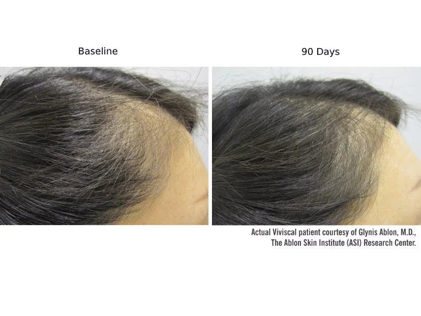Viviscal PRO Advanced Hair Health